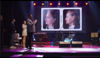 SweDermis Dermal Filler Sweden